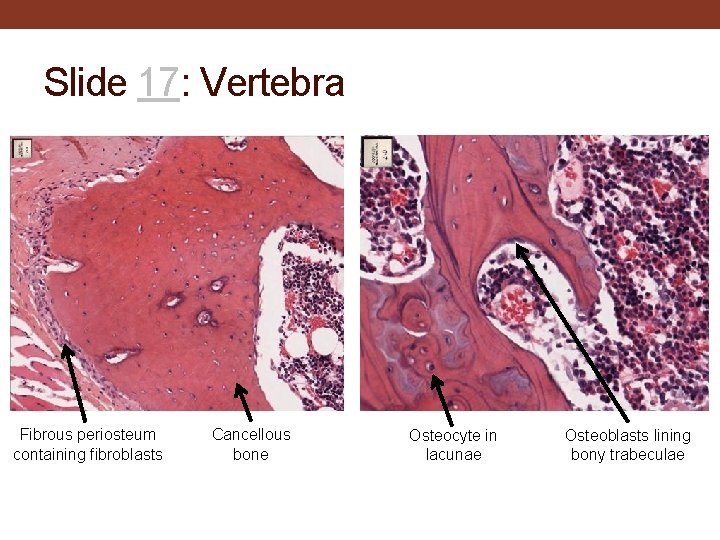 Slide 17: Vertebra Fibrous periosteum containing fibroblasts Cancellous bone Osteocyte in lacunae Osteoblasts lining