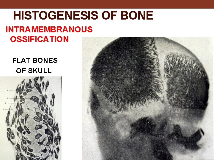 HISTOGENESIS OF BONE INTRAMEMBRANOUS OSSIFICATION FLAT BONES OF SKULL 