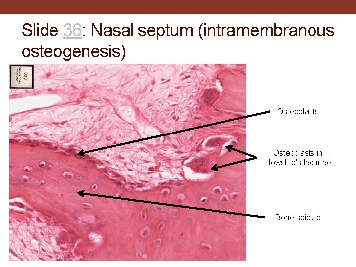 Slide 36: Nasal septum (intramembranous osteogenesis) Osteoblasts Osteoclasts in Howship’s lacunae Bone spicule 