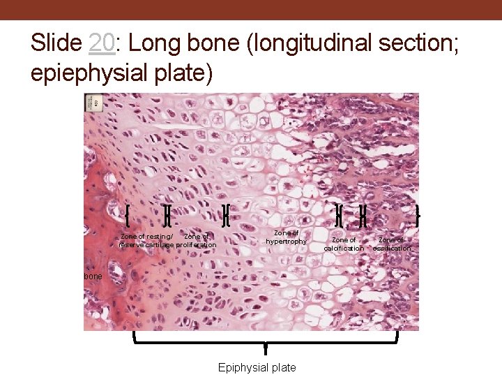 Slide 20: Long bone (longitudinal section; epiephysial plate) Zone of resting/ Zone of reserve