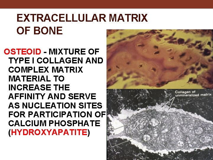 EXTRACELLULAR MATRIX OF BONE OSTEOID - MIXTURE OF TYPE I COLLAGEN AND COMPLEX MATRIX