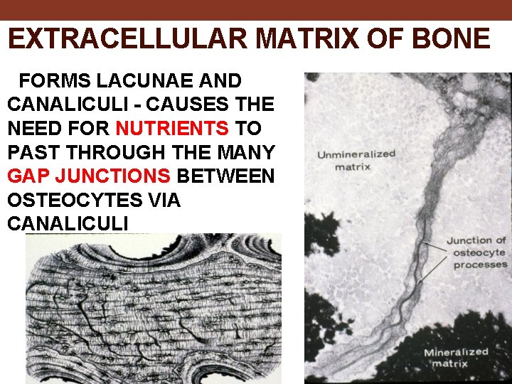 EXTRACELLULAR MATRIX OF BONE FORMS LACUNAE AND CANALICULI - CAUSES THE NEED FOR NUTRIENTS