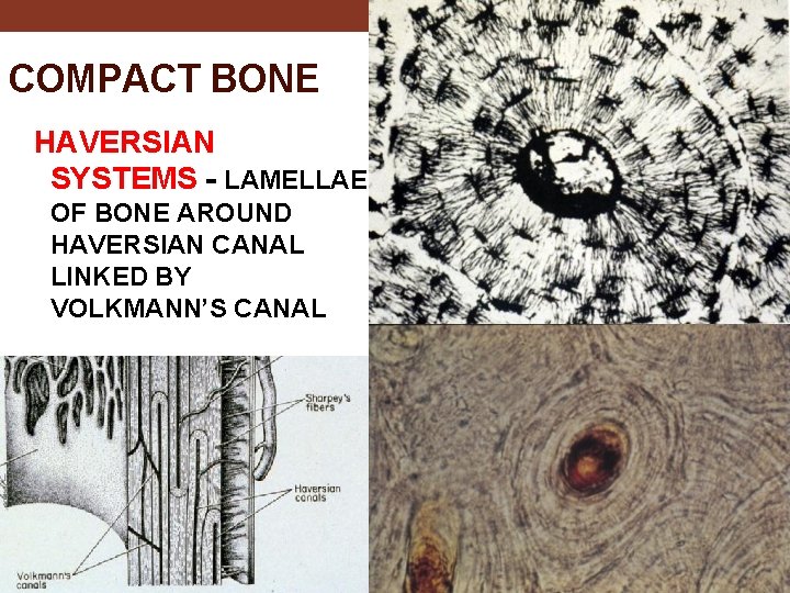 COMPACT BONE HAVERSIAN SYSTEMS - LAMELLAE OF BONE AROUND HAVERSIAN CANAL LINKED BY VOLKMANN’S