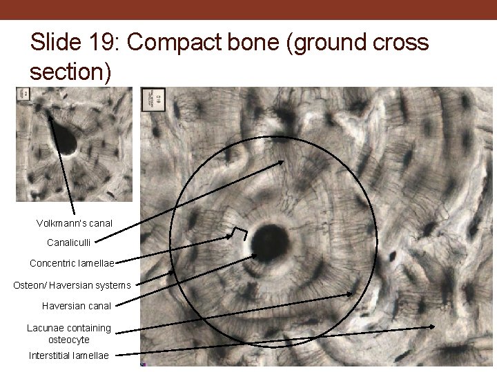 Slide 19: Compact bone (ground cross section) Volkmann’s canal Canaliculli Concentric lamellae Osteon/ Haversian