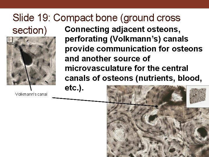 Slide 19: Compact bone (ground cross Connecting adjacent osteons, section) Volkmann’s canal perforating (Volkmann’s)