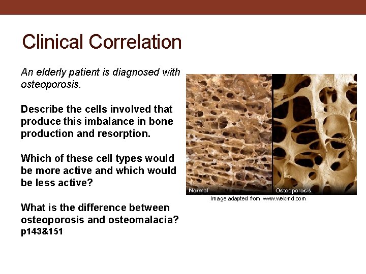 Clinical Correlation An elderly patient is diagnosed with osteoporosis. Describe the cells involved that