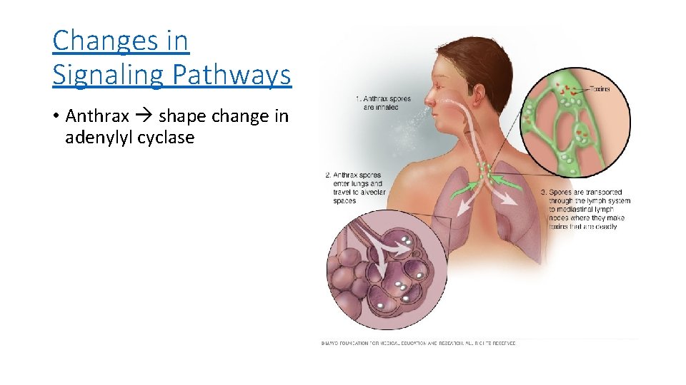 Changes in Signaling Pathways • Anthrax shape change in adenylyl cyclase Changes in Signaling Pathways • Anthrax shape change in adenylyl cyclase