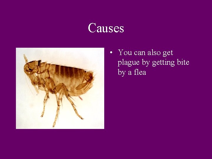 Causes • You can also get plague by getting bite by a flea 