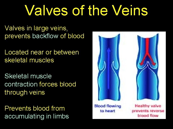 Valves of the Veins Valves in large veins, prevents backflow of blood Located near