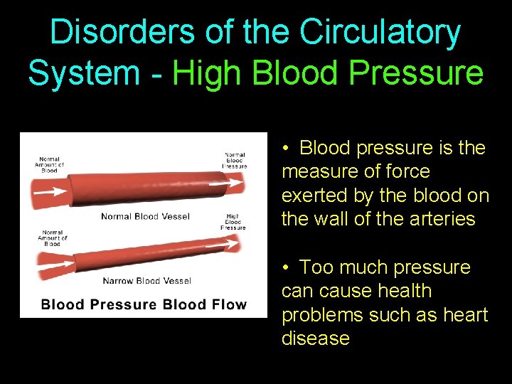 Disorders of the Circulatory System - High Blood Pressure • Blood pressure is the