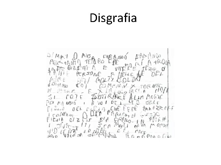 Disgrafia 