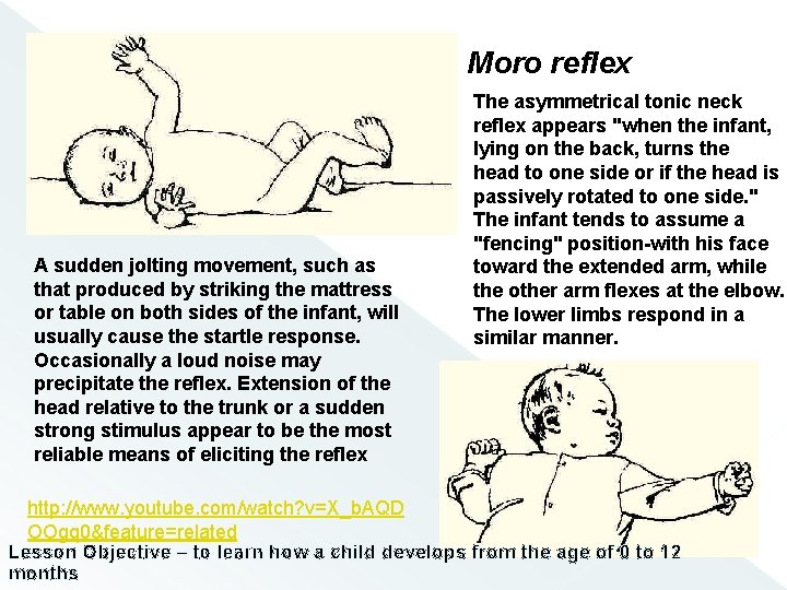 Moro reflex A sudden jolting movement, such as that produced by striking the mattress