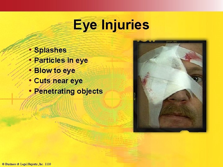 Eye Injuries • Splashes • Particles in eye • Blow to eye • Cuts