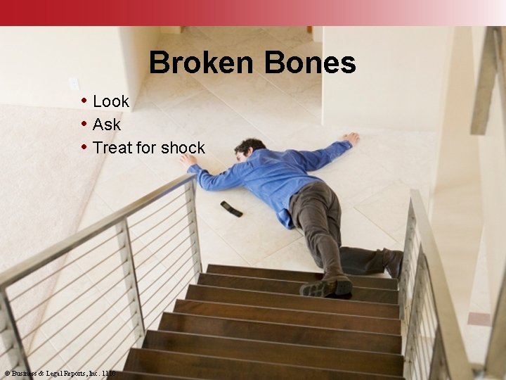 Broken Bones • Look • Ask • Treat for shock © Business & Legal