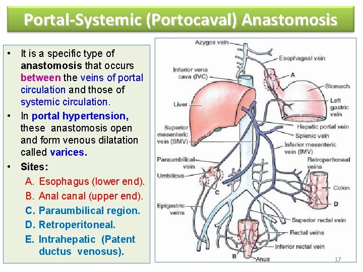 Portal-Systemic (Portocaval) Anastomosis • It is a specific type of anastomosis that occurs between