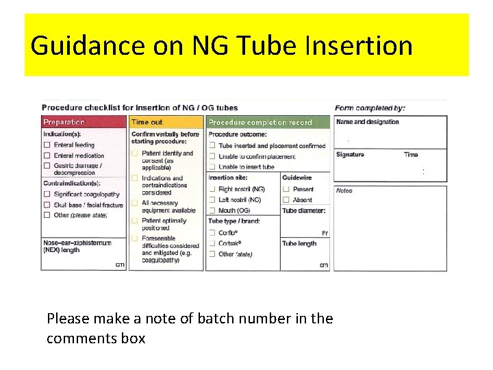 Guidance on NG Tube Insertion Please make a note of batch number in the