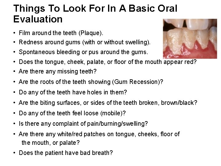 Things To Look For In A Basic Oral Evaluation • Film around the teeth