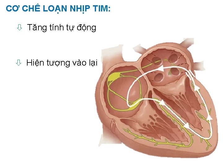 CƠ CHẾ LOẠN NHỊP TIM: ò Tăng tính tự động ò Hiện tượng vào