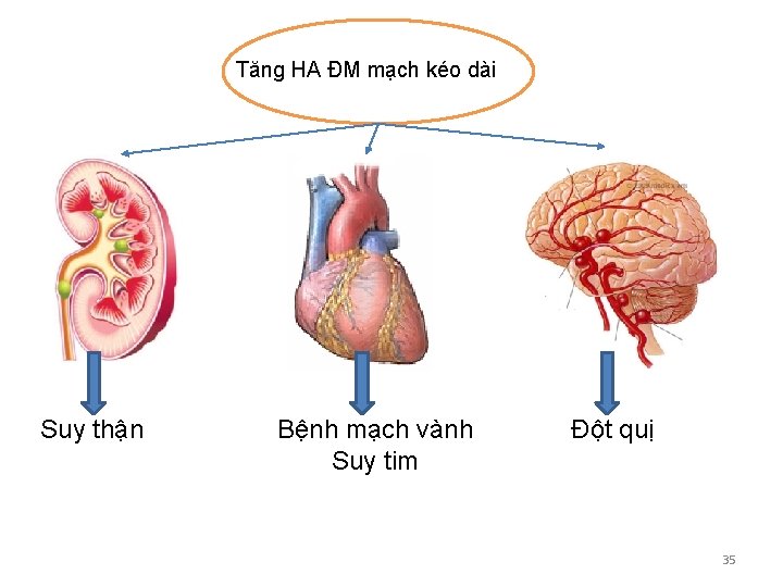 Tăng HA ĐM mạch kéo dài Suy thận Bệnh mạch vành Suy tim Đột