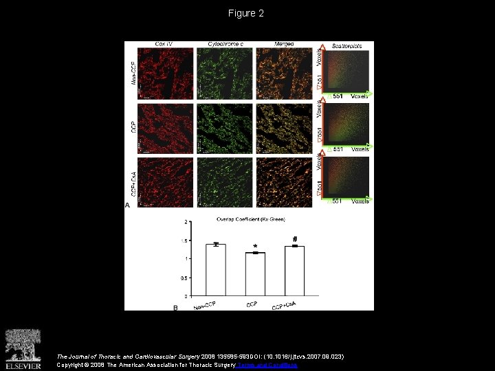 Figure 2 The Journal of Thoracic and Cardiovascular Surgery 2008 135585 -593 DOI: (10.