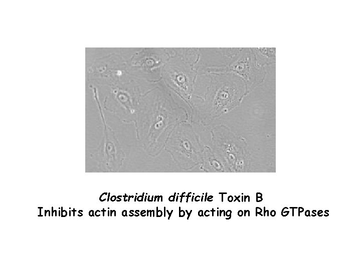 Clostridium difficile Toxin B Inhibits actin assembly by acting on Rho GTPases 