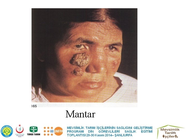 Mantar 54 