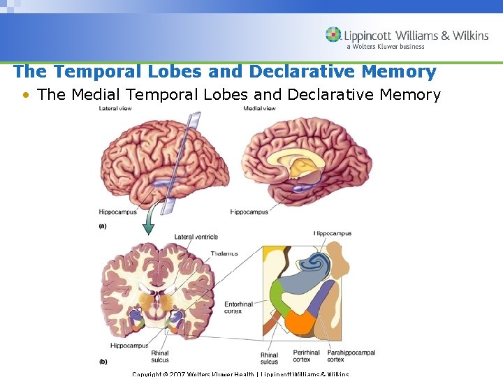 The Temporal Lobes and Declarative Memory • The Medial Temporal Lobes and Declarative Memory