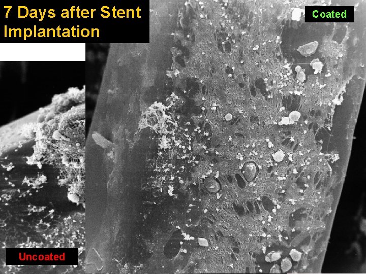 7 Days after Stent Implantation Uncoated Coated 