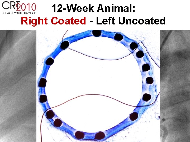 12 -Week Animal: Right Coated - Left Uncoated 