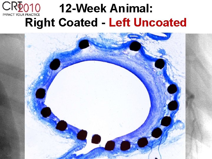 12 -Week Animal: Right Coated - Left Uncoated 