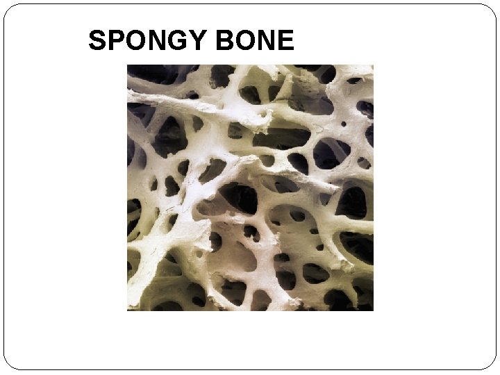 SPONGY BONE 