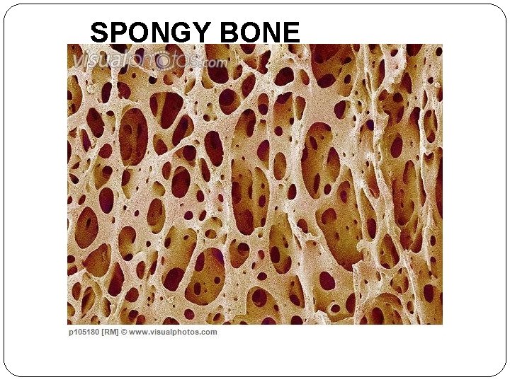 SPONGY BONE  SPONGY BONE