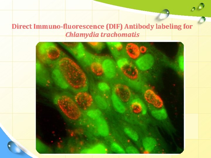 Direct Immuno-fluorescence (DIF) Antibody labeling for Chlamydia trachomatis 