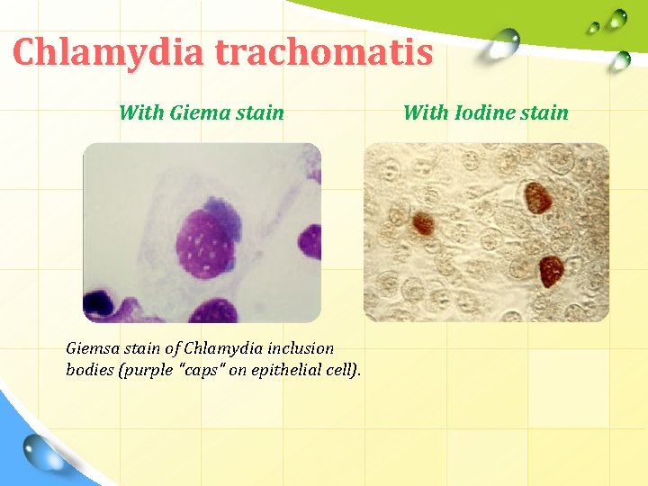 Chlamydia trachomatis With Giema stain Giemsa stain of Chlamydia inclusion bodies (purple "caps" on