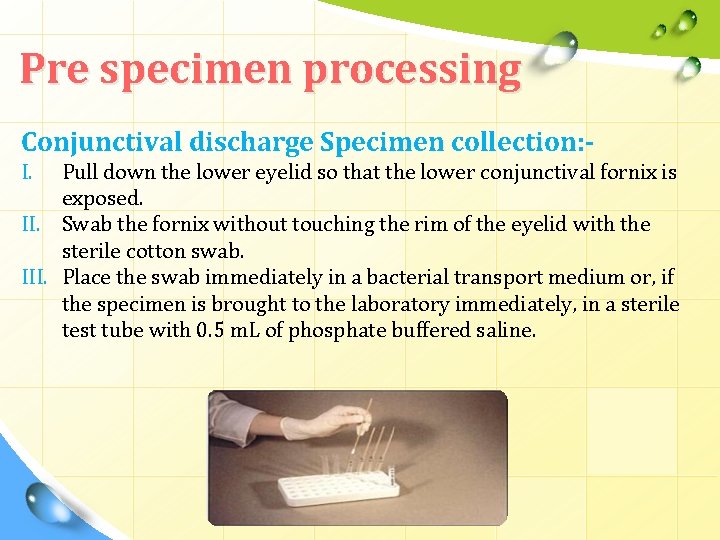 Pre specimen processing Conjunctival discharge Specimen collection: I. Pull down the lower eyelid so