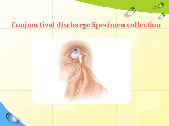 Conjunctival discharge Specimen collection 