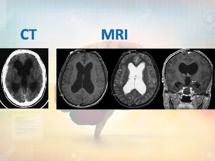 CT MRI 