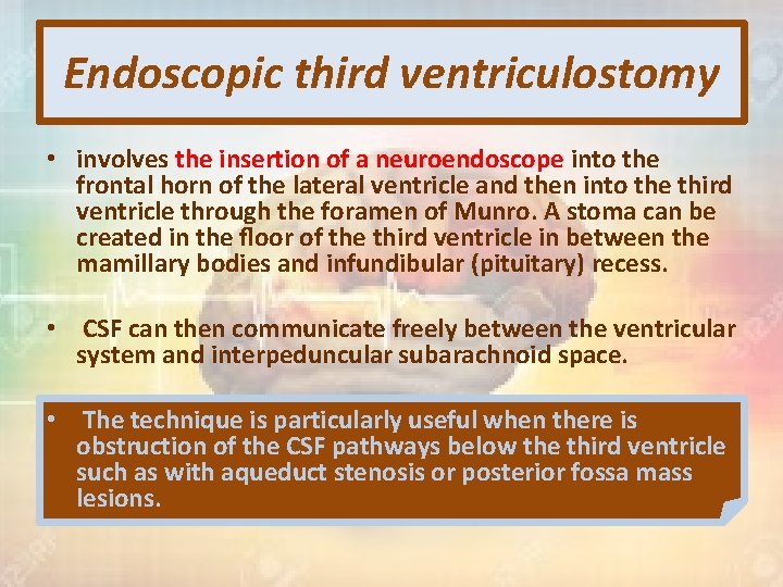 Endoscopic third ventriculostomy • involves the insertion of a neuroendoscope into the frontal horn