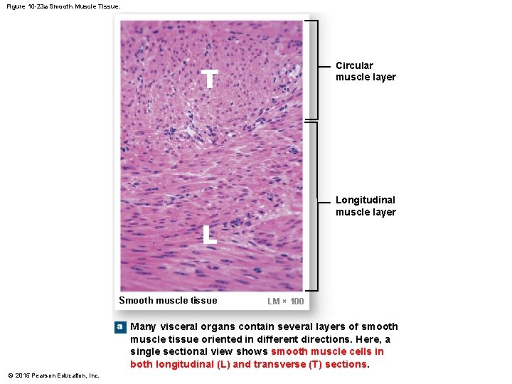 Figure 10 -23 a Smooth Muscle Tissue. T Circular muscle layer Longitudinal muscle layer