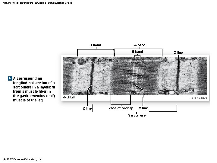 Figure 10 -4 b Sarcomere Structure, Longitudinal Views. I band A band H band