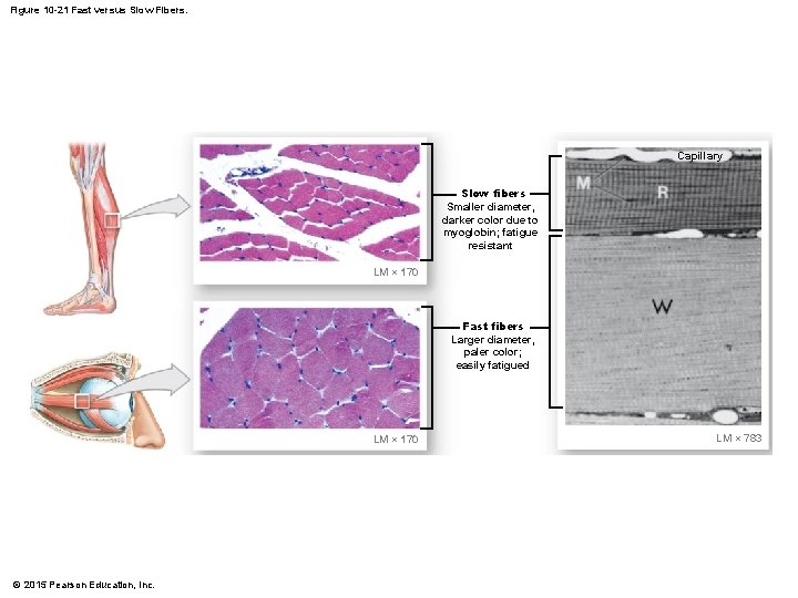 Figure 10 -21 Fast versus Slow Fibers. Capillary Slow fibers Smaller diameter, darker color
