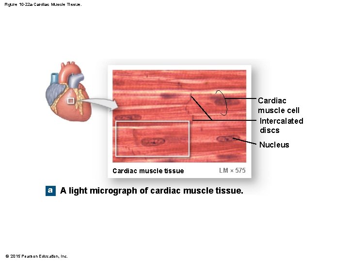 Figure 10 -22 a Cardiac Muscle Tissue. Cardiac muscle cell Intercalated discs Nucleus Cardiac
