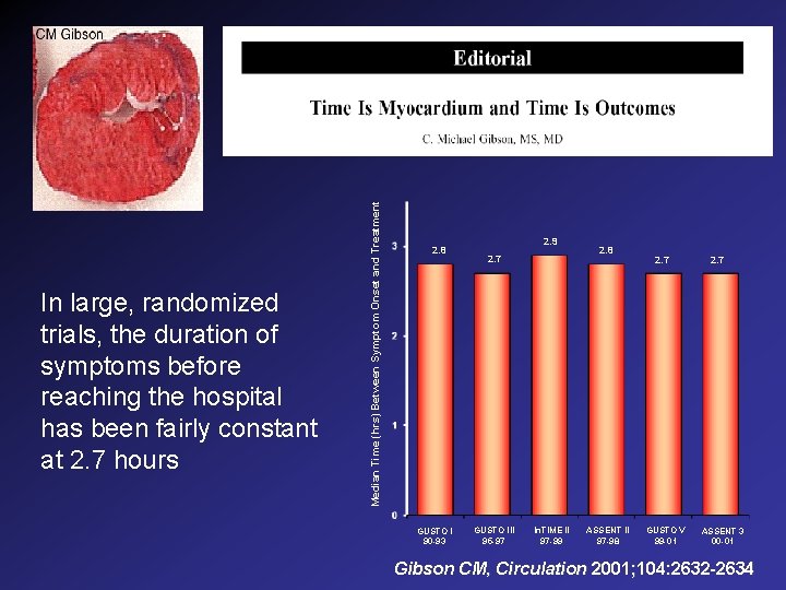 Median Time (hrs) Between Symptom Onset and Treatment In large, randomized trials, the duration