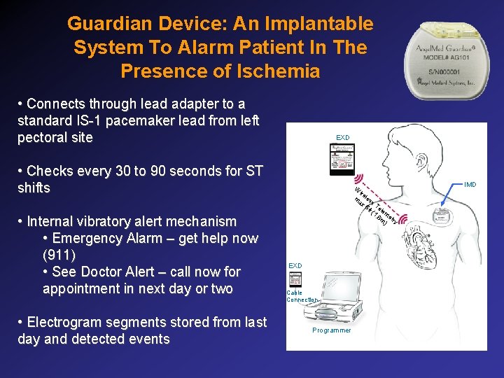 Guardian Device: An Implantable System To Alarm Patient In The Presence of Ischemia •