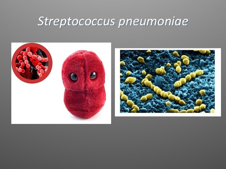 Streptococcus pneumoniae 