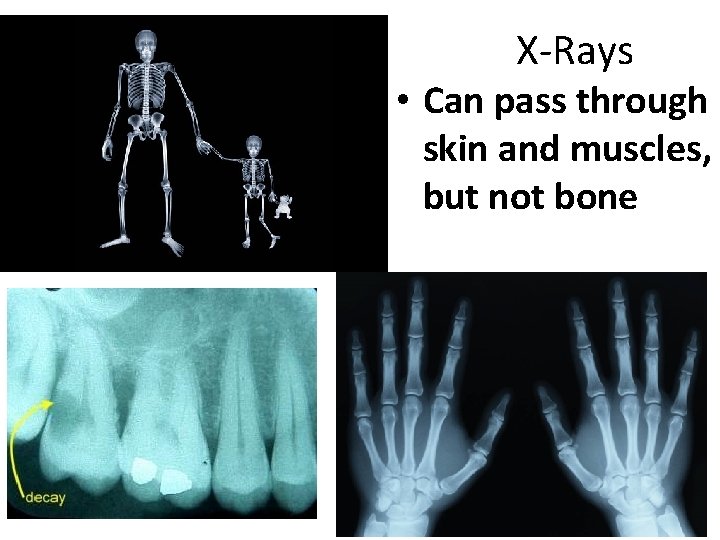 X-Rays • Can pass through skin and muscles, but not bone 