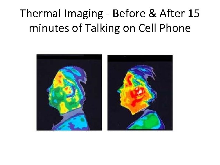 Thermal Imaging - Before & After 15 minutes of Talking on Cell Phone 
