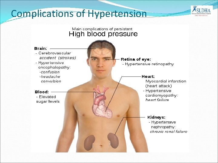 Complications of Hypertension 
