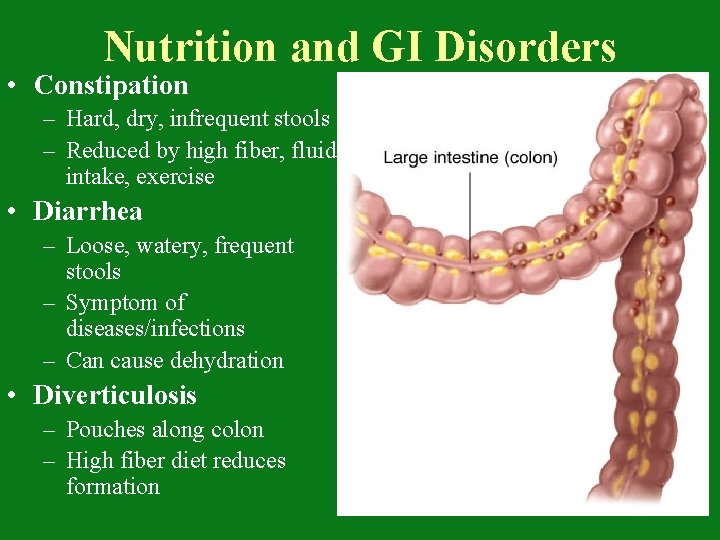Nutrition and GI Disorders • Constipation – Hard, dry, infrequent stools – Reduced by