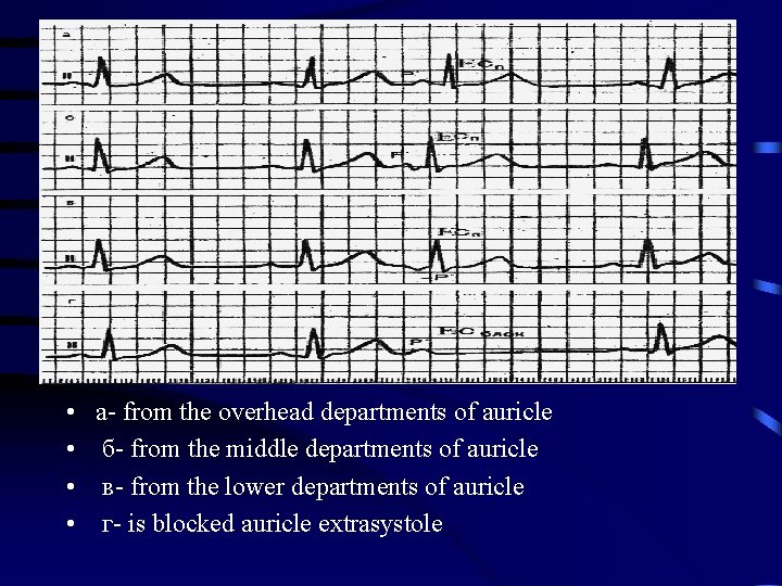  • • a- from the overhead departments of auricle б- from the middle
